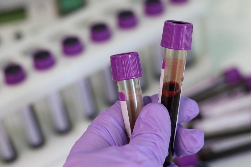 В США выявили наименее уязвимую к коронавирусу группу крови