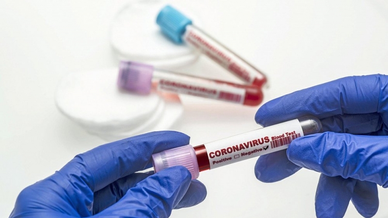 Более 6 тысяч южноуральцев заразились коронавирусом