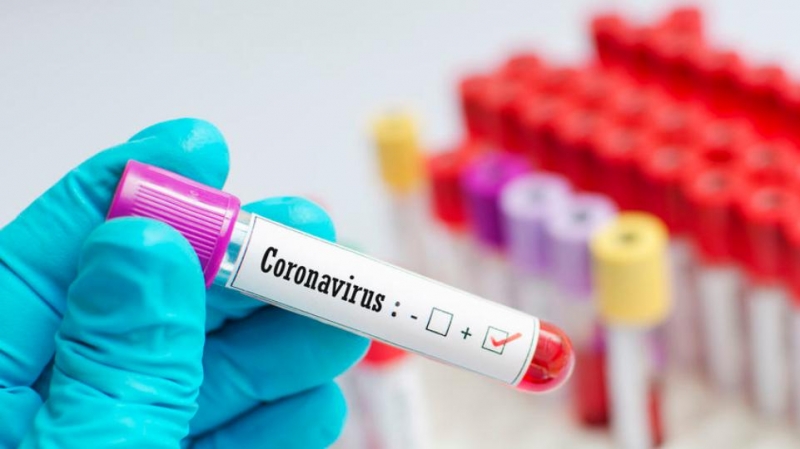 81 пациент заболел коронавирусом в Челябинской области