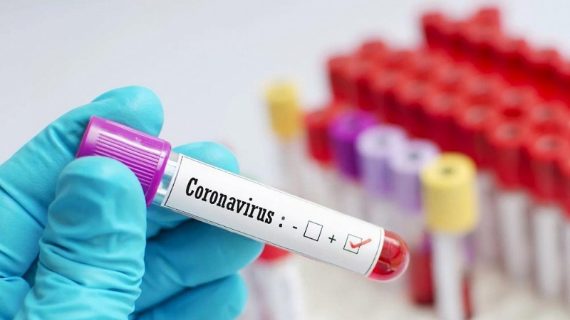 В Челябинской области за сутки коронавирусом заразились 93 человека