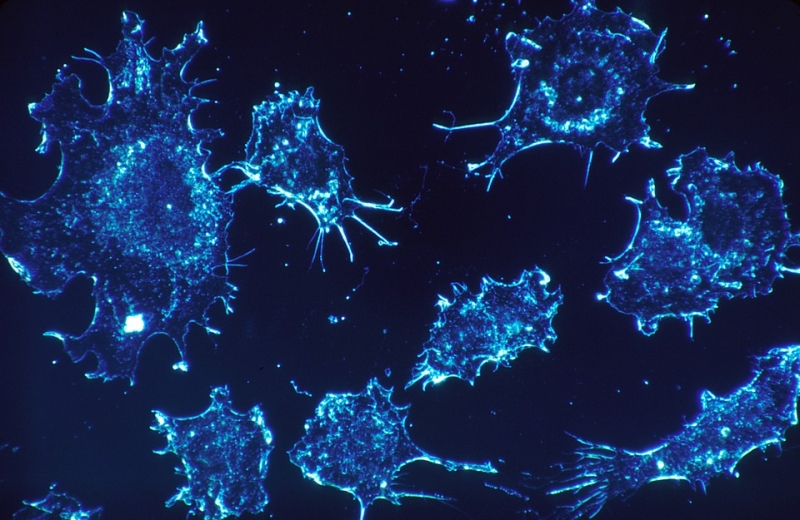 Найден способ выявить 50 типов рака на ранней стадии