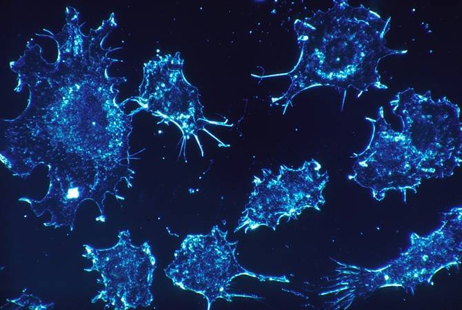 
Раковые клетки могут переходить в «спящий» режим во время курсов химиотерапии                