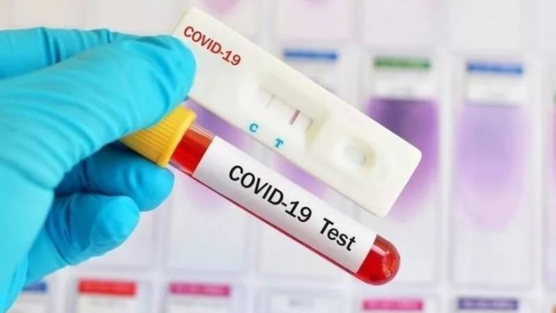 
Сколько антител должно быть в организме после прививки от COVID-19, какая норма                