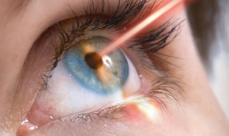 
Делать ли лазерную коррекцию людям с плохим зрением: плюсы и минусы                