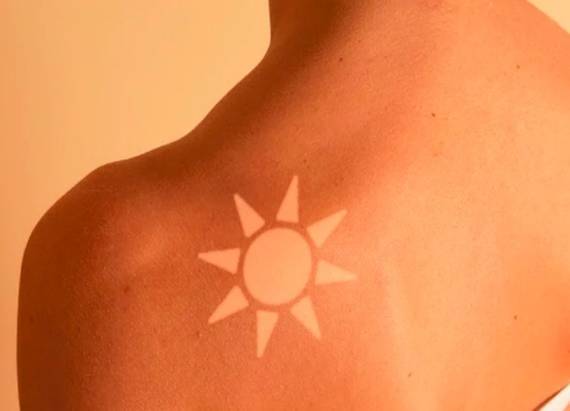 
«Смертельный тренд»: что такое солнечное тату, и в чем его опасность                
