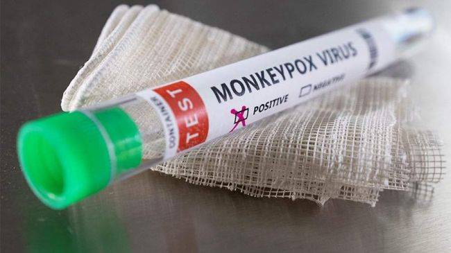 
Вспышка обезьяньей оспы: ученые назвали неожиданную причину вируса                