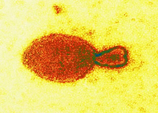 
Какие симптомы у нового опасного вируса Ланья и где его впервые обнаружили                