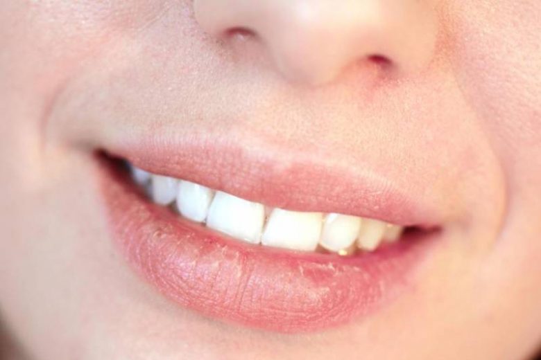 
«Крик» о помощи: что губы говорят о вашем здоровье                