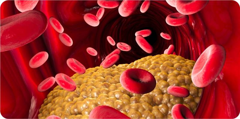
Специалисты разъяснили, как часто нужно сдавать кровь на холестерин                